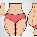 10 Simple Tricks To Burn Fat Naturally (And Without Exercise)