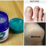 How To Use Vicks VapoRub in 11 Unique Ways