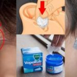 She Puts Vaporub On A Cotton Ball And Sticks It In Her Ear… Moments Later? Incredible!